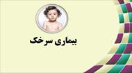 پاورپوینت بیماری سرخک